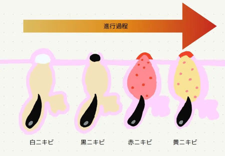 根本的な原因にアプローチ
